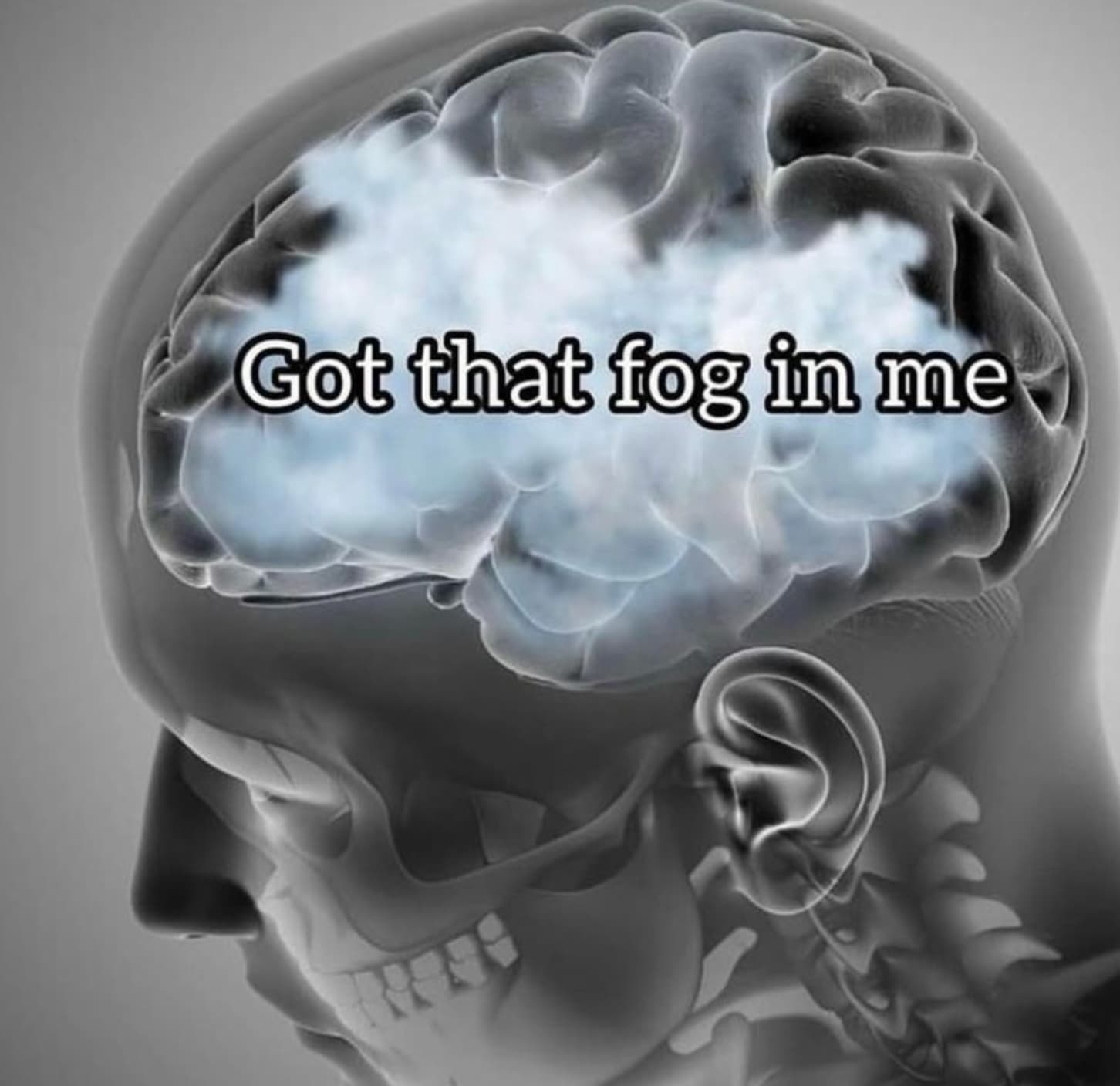 brain tumor - Got that fog in me